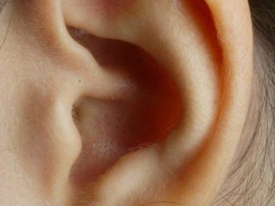 Purim – Condicionamento auditivo
